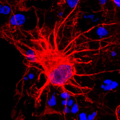 Pasca's Astrocytes