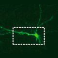 Human induced neuron transplanted into mouse brain