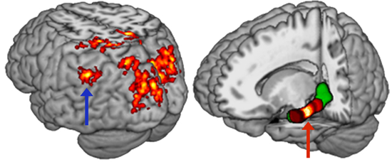 fMRI memory circuit