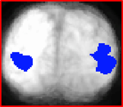 visual cortex activity