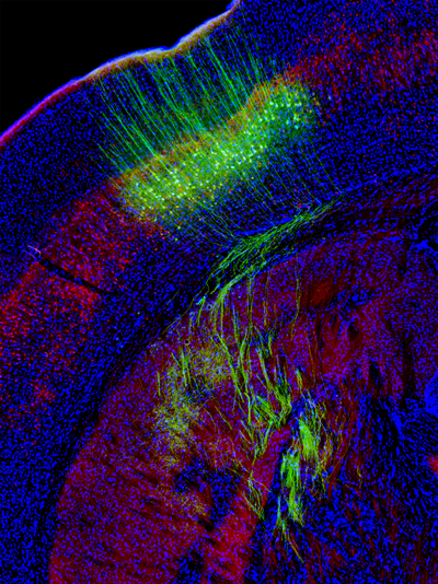 pyramidal neurons of the mouse cerebral cortex