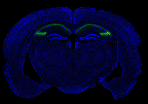 highlighted CA2 region of hippocampus in mouse brain