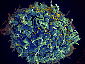 HIV infecting T-Cell