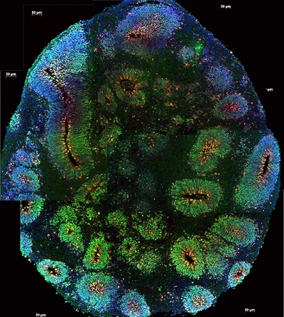 screenshot from a brain scan showing human cortex organoids