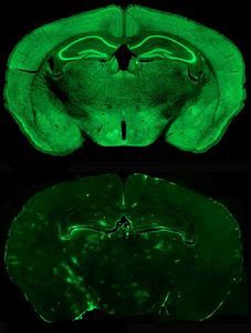 Mouse brains showing presence and absence of gene