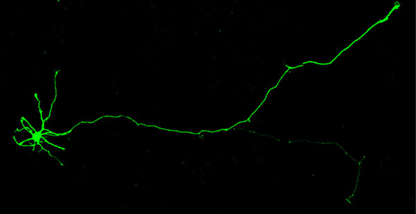 microscopic image of an induced human neuron