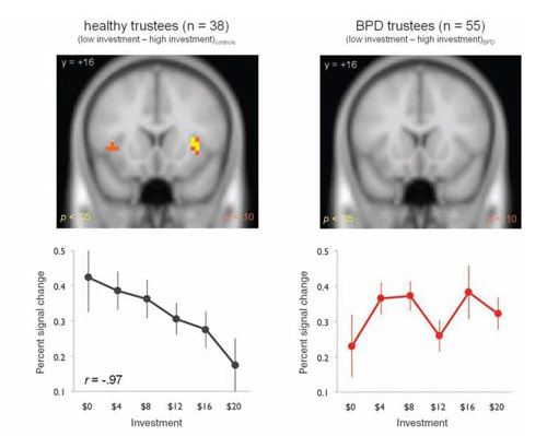 Brain activity during investment game in healthy participants compared with participants with borderline personality disorder