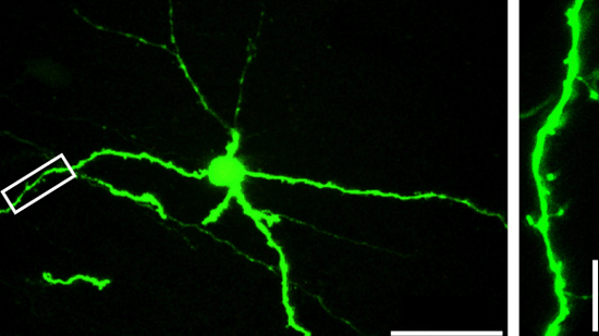 lateral habenula neuron