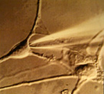 electron micrograph of human neurons
