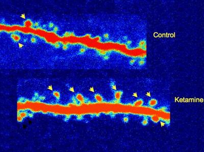 neuronal spines on ketamine-treated rat neurons