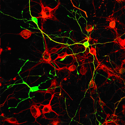 Graphic of stem cells giving birth to new neurons in the hippocampus