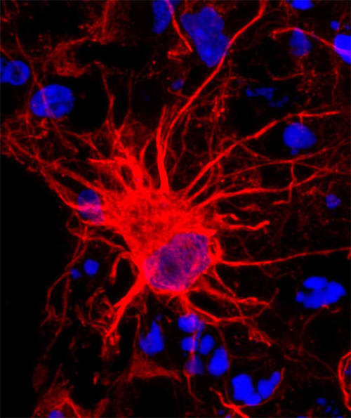 Pasca's Astrocytes