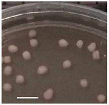 Budding brain-like 'human cortical spheroids' growing in a petri dish. Source: Sergiu Pasca, M.D., Stanford University