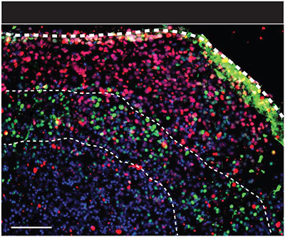 Neurons and supporting cells in the spheroids form layers and organize themselves according to the architecture of the developing human brain and network with each other.  Source: Sergiu Pasca, M.D., Stanford University