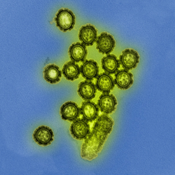 H1N1 influenza virus particles