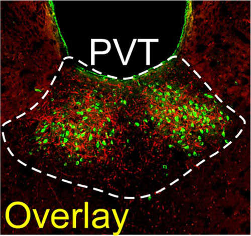 An overlay image of the PVT showing the terminals from the locus coeruleus (red) and the neurons that project to the nucleus accumbens (green).