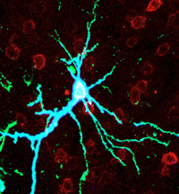 Neuron over-expressing PKMzeta