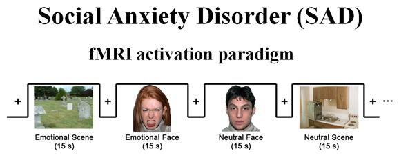 social anxeity disorder - fMRI image examples 
