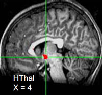 Hypothalamus, a node of the emotion circuit
