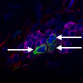 Image showing HIV infection of CD4+ T cells in the mouse brain. Human T cells (magenta), human astrocytes (red), HIV (green), nuclei (Blue). Arrows identify uptake of HIV from astrocytes into T cells. Credit: Al-Harthi et al. (2020)