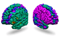 MRI brain map of tissue thickness