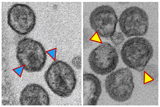 Electron microscopy of HIV. Left: Mature, fully formed HIV particles (blue arrows). Right: Immature, misshaped HIV particles (yellow arrows) that formed following treatment with the nSMase2-blocking compound that stopped growth of the virus. Credit: Abdul Waheed, Ph.D., Center for Cancer Research, National Cancer Institute, National Institutes of Health.