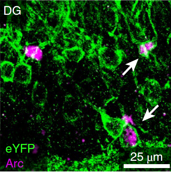 Image showing immunofluorescence of fear-acquisition tagged neurons in the dentate gyrus during spontaneous recovery. Credit: Springer Nature; Lacagnina et al. 2019