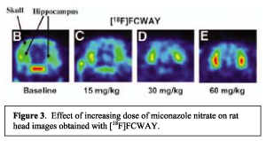 Effect of increasing dose of miconazole nitrate on rat head images obtained with [18F]FCWAY 
