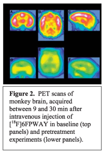PET scans of monkey brain