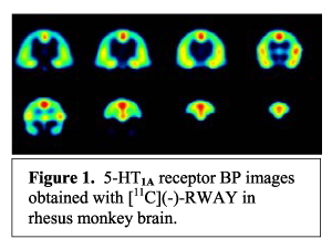 Figure 1: 5-HT1A receptor BP images obtained with [11C](-)-RWAY in rhesus monkey brain.