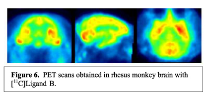 Figure 6: PET scans obtained in rhesus monkey brain with [11C]Ligand B