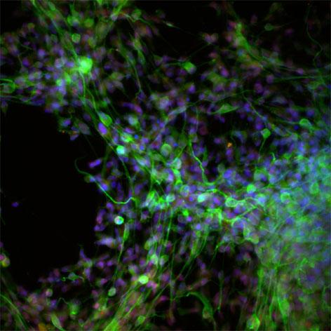 Neural stem cells express markers of neural progenitors in culture.