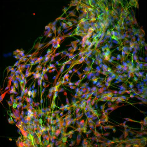 Neural stem cells express markers of neural progenitors in culture.