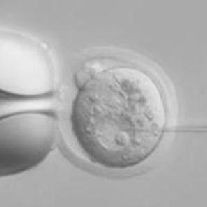 To make a transgenic mouse DNA is injected into one of the two pronuclei from a recently fertilized mouse egg.