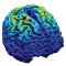 Image of brain using color to show the strength of electric field generated through MST.